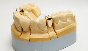 貴金属リサイクルイメージ